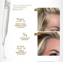 Load image into Gallery viewer, Goldie Locks Scalp Serum