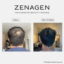 Load image into Gallery viewer, Zenagen Revolve Thickening Shampoo for Men

