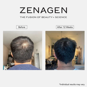 Zenagen Revolve Thickening Shampoo for Men